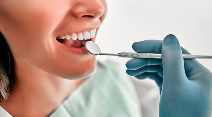 Decaying Teeth, Localised Periodontal Disease and Stress localised periodontal disease